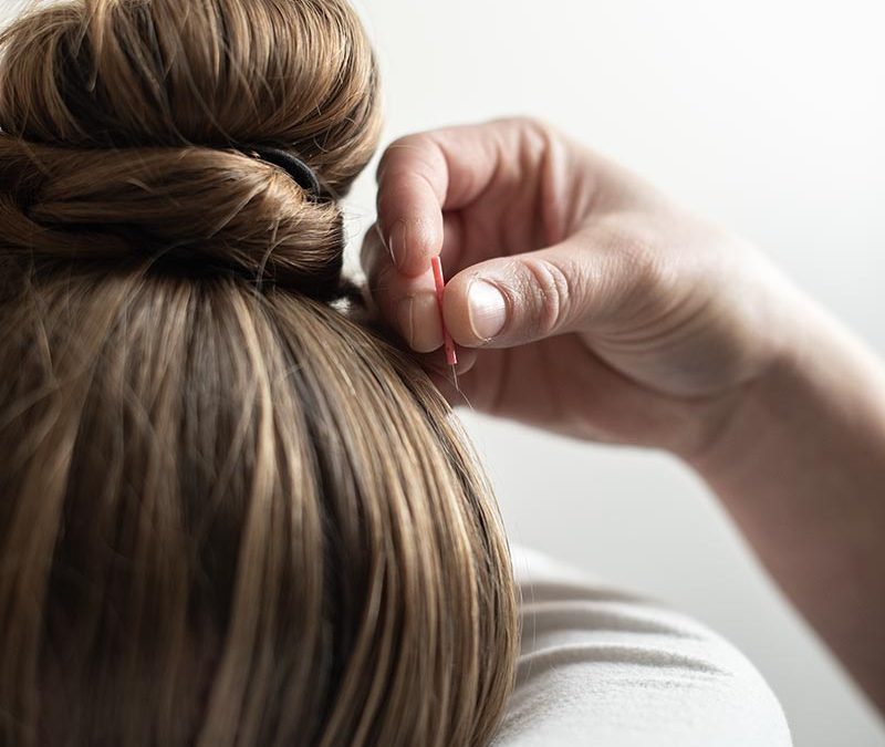 Discovering Relief: How Acupuncture Offers Hope for Migraine Sufferers